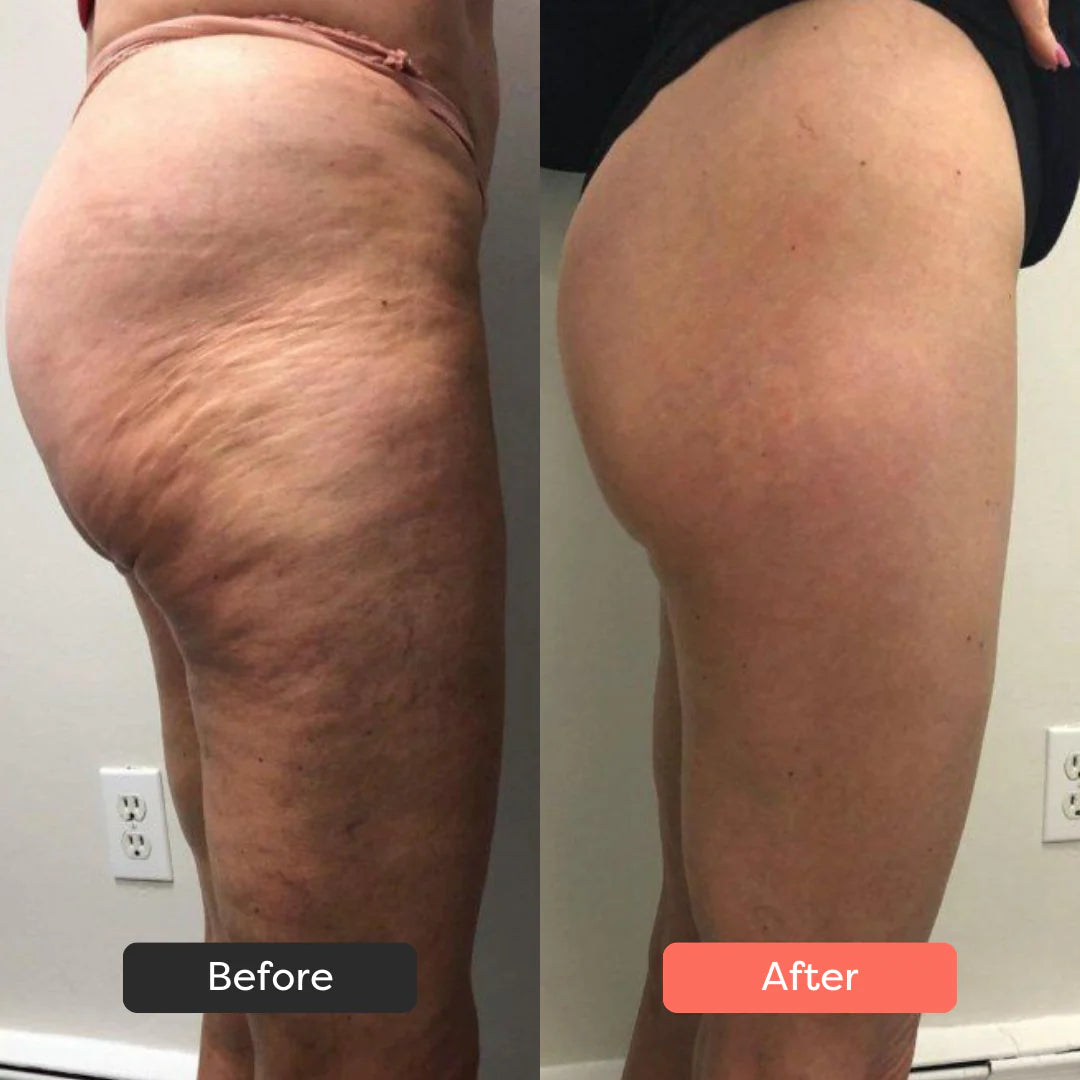 3-in-1 Portable Body Sculpting Massager